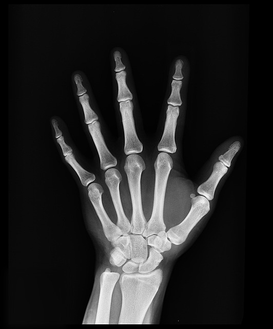 x-ray-1704855_640